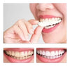 DentPro Carillas Dentales